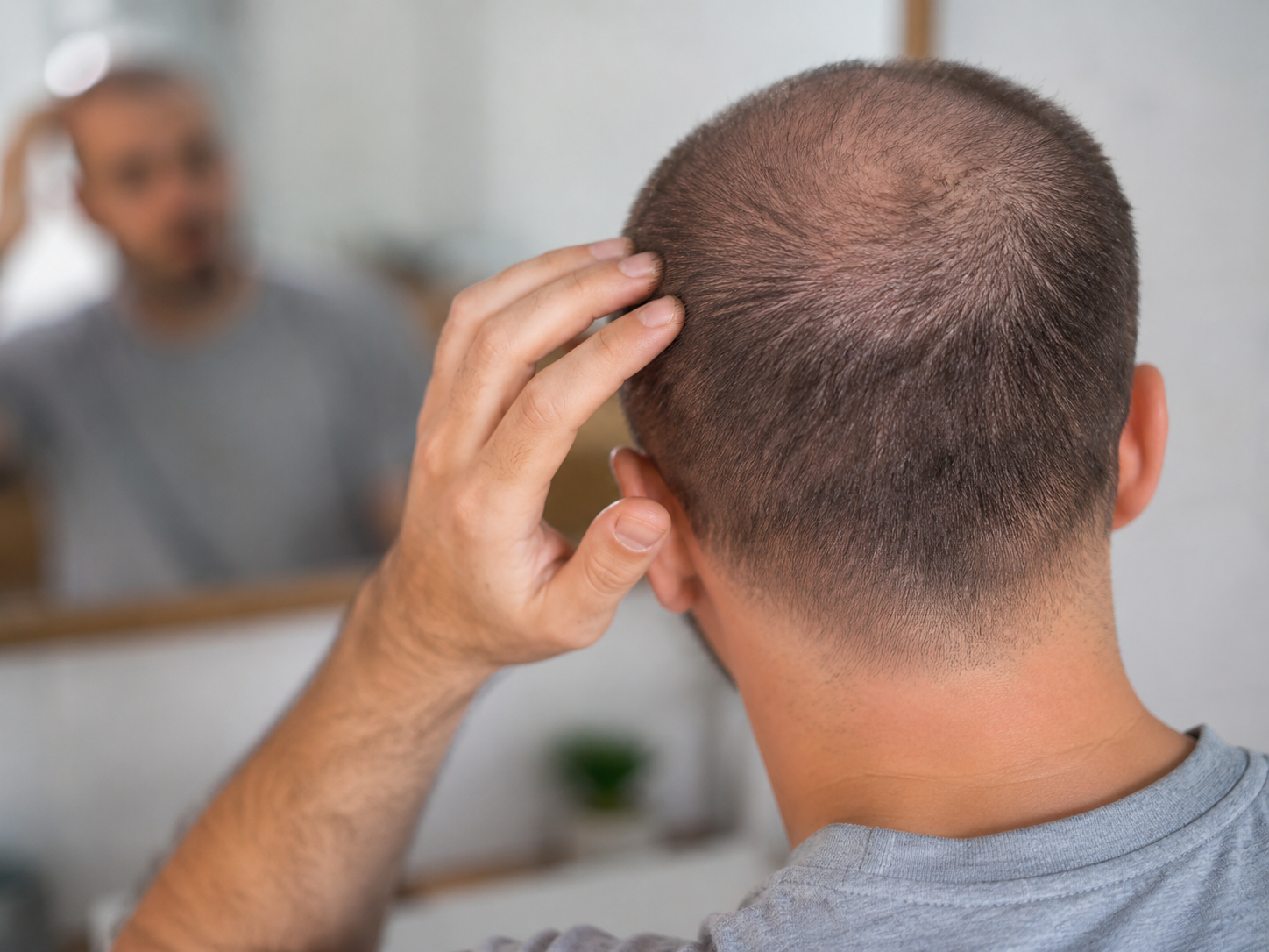 Post hair transplant scalp care guidance at IHT India