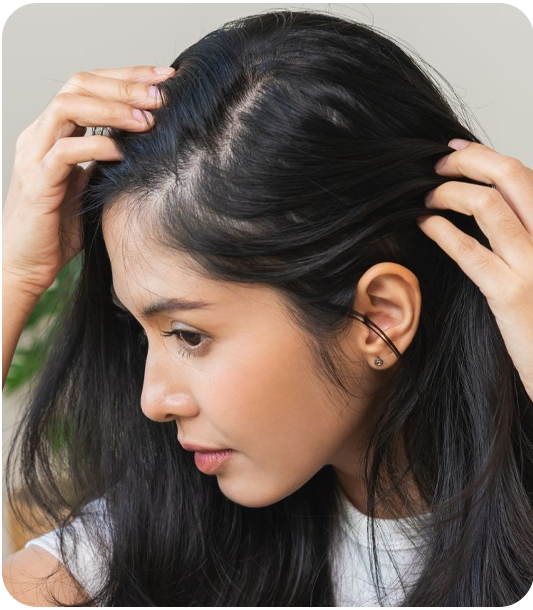 Genetic hair loss and androgenetic alopecia affecting hair follicles