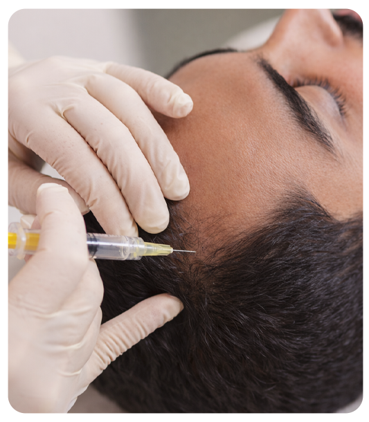 Who should consider GFC therapy for hair loss